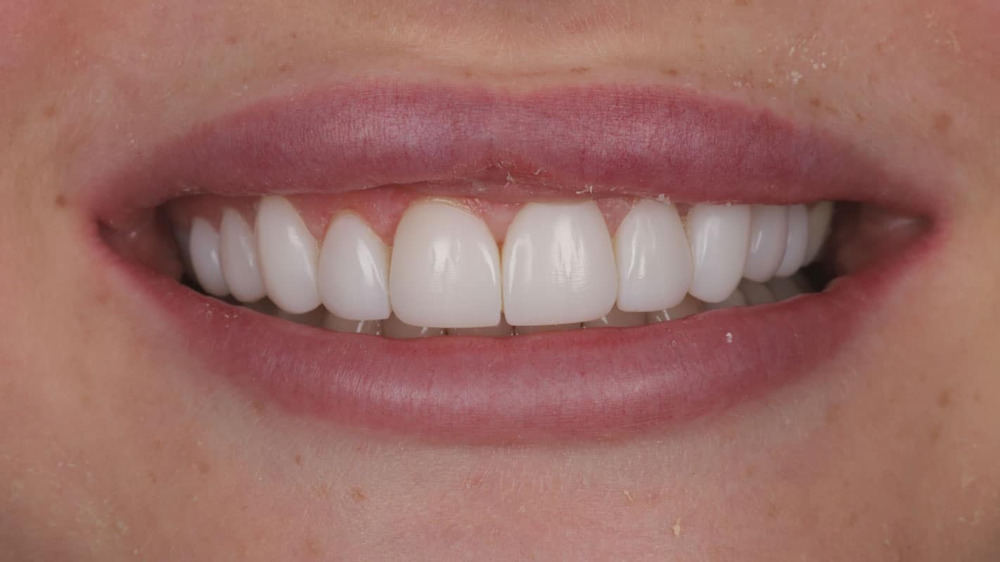 AfterSmileTransformation