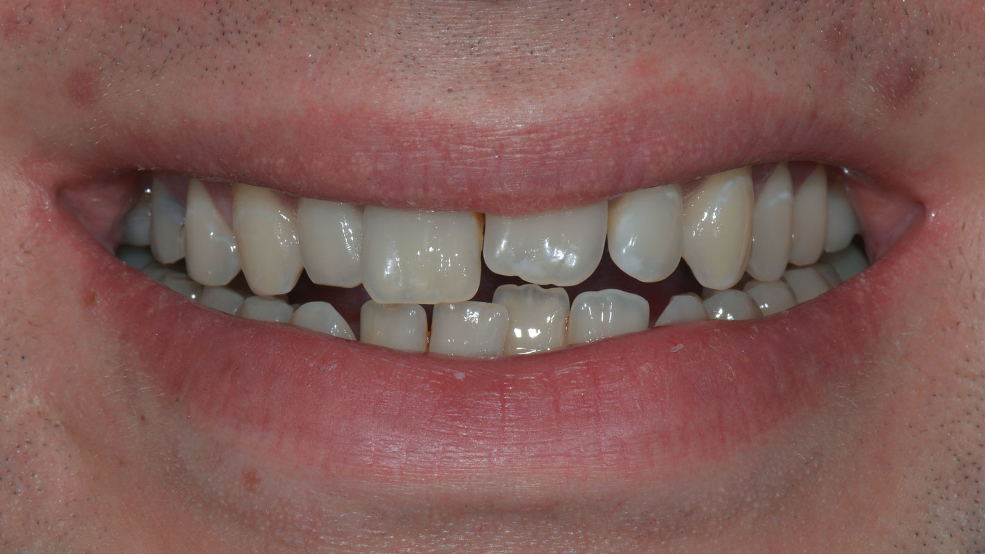 TransformationBefore